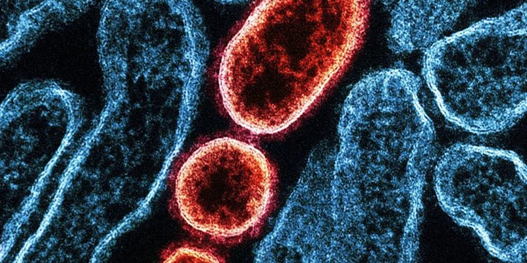 controale-amanuntite-in-aeroporturi-din-asia-dupa-ce-india-anunta-noi-infectii-cu-virusul-nipah