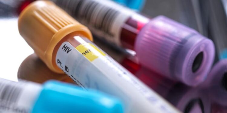 un-barbat-s-a-vindecat-de-hiv-dupa-un-transplant-de-celule-stem-de-la-fratele-sau:-parca-am-castigat-la-loterie-de-doua-ori-–-hotnews.ro