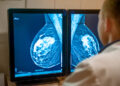 un-test-genetic-revolutionar-poate-oferi-milioanelor-de-paciente-cu-cancer-de-san-sansa-de-a-evita-chimioterapia-–-hotnews.ro