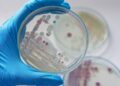 alerta-sanitara-pe-litoralul-european:-incalzirea-apei-marii-aduce-o-bacterie-periculoasa-aproape-de-plaje