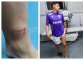 a-ajuns-direct-la-spital-dupa-faza-din-fc-arges-–-sepsi!-gazdele-acuza-ca-n-a-functionat-var-ul