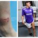 a-ajuns-direct-la-spital-dupa-faza-din-fc-arges-–-sepsi!-gazdele-acuza-ca-n-a-functionat-var-ul